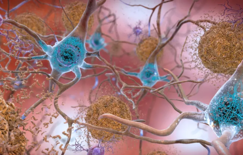 Découverte révolutionnaire sur l'Alzheimer : une nouvelle piste de traitement s'ouvre