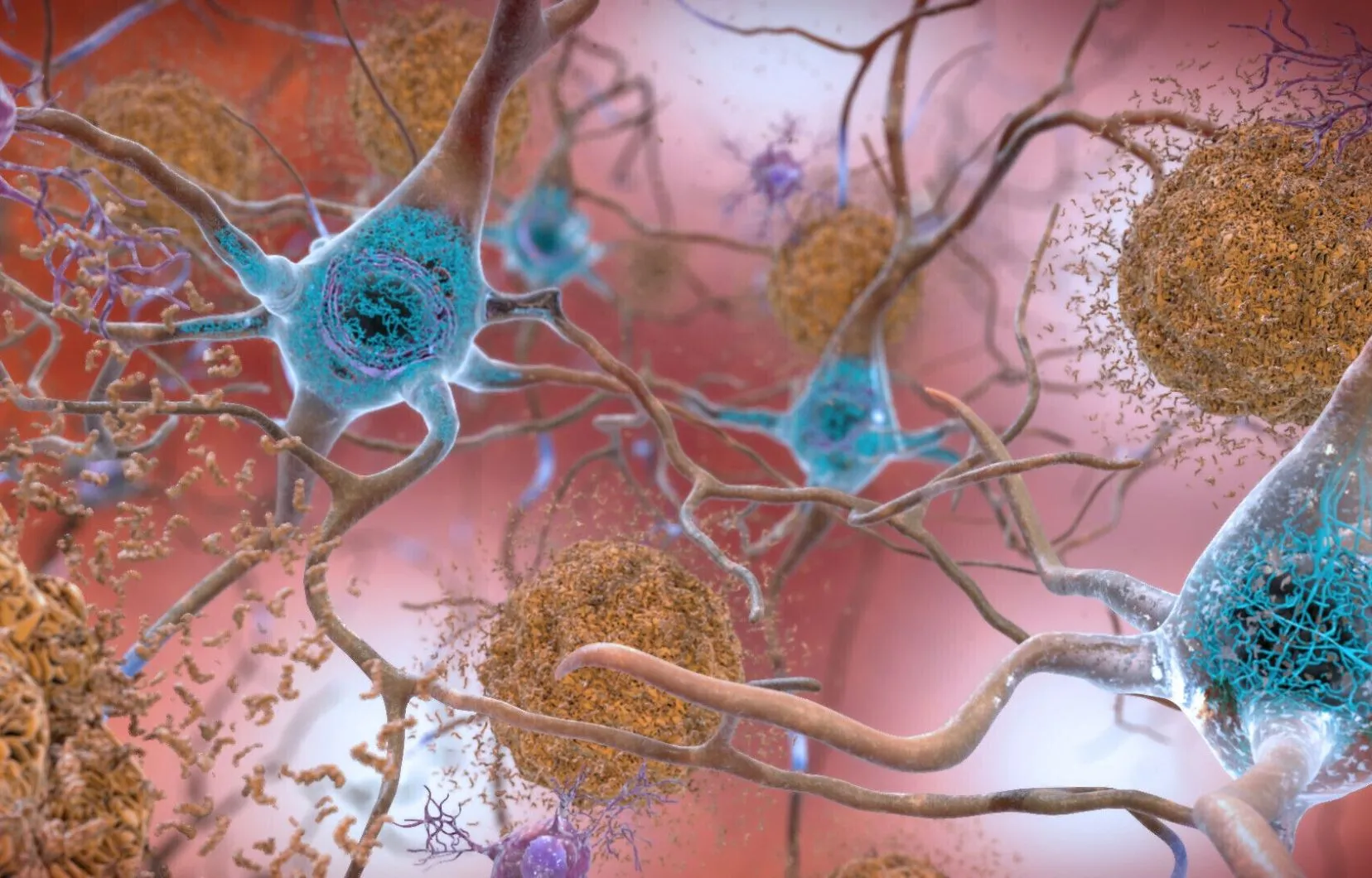 Découverte révolutionnaire sur l'Alzheimer : une nouvelle piste de traitement s'ouvre