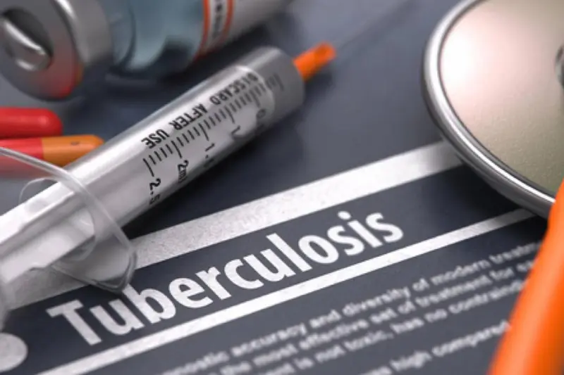 Vaccin contre la tuberculose : premiers essais cliniques lancés en Afrique du Sud en 2025