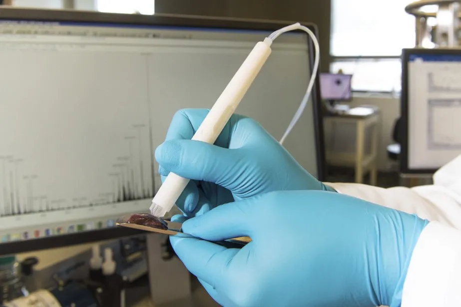 Une sonde montréalaise qui voit le cancer que l'œil ne voit pas